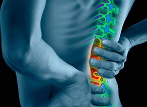 Ihe kpatara na akara nke osteochondrosis