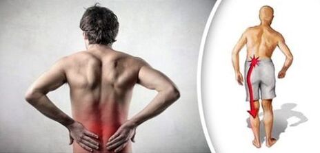 Ọrịa mgbu na lumbar osteochondrosis na-eweta ụkwụ
