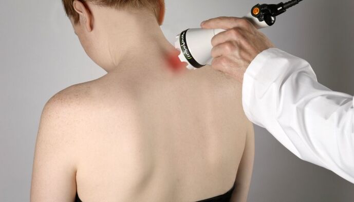 Ọgwụgwọ laser maka osteochondrosis cervical
